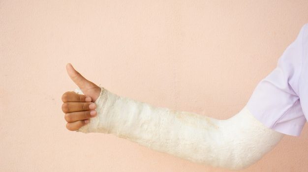 casts