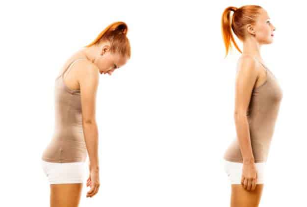 Stretching and strengthening exercises are an essential part of Rounded shoulder and frozen shoulder treatment.