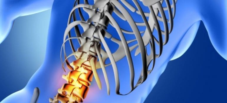 lower back pain treatment in Gurgaon