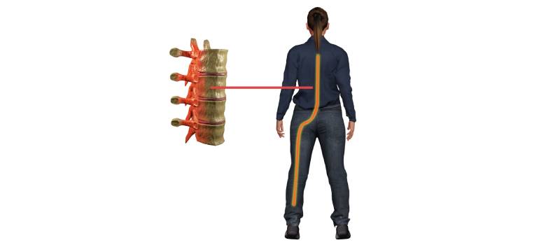 orthob12