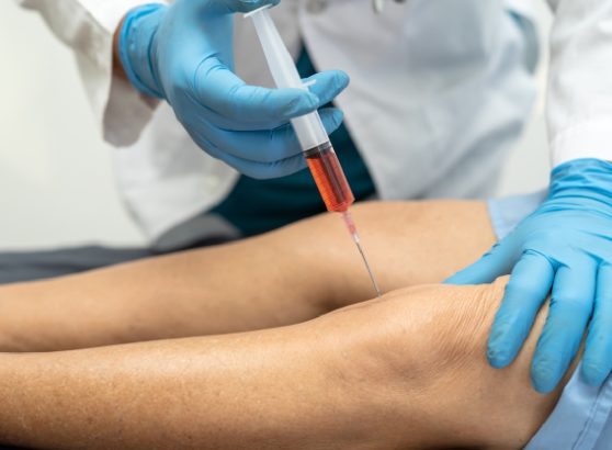 specialist-injecting-platelet-rich-plasma-prp-into-the-knee-joint