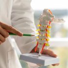 diagram-of-the-cervical-and-lumbar-spine-showing-disc-degeneration-and-bone-spurs