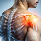 anatomical-diagram-of-the-shoulder-joint-showing-the-ligaments-and-rotator-cuff-tendons