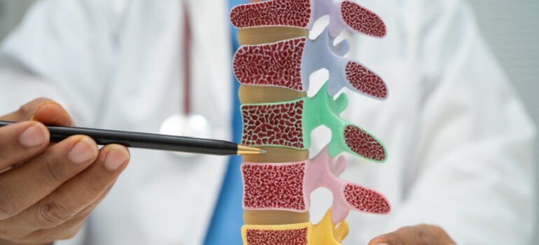 diagram-showing-the-stages-of-disc-degeneration-from-healthy-to-desiccated
