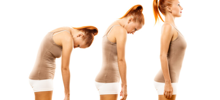 diagram-showing-the-subacromial-space-in-a-neutral-posture-versus-a-rounded-shoulder-posture