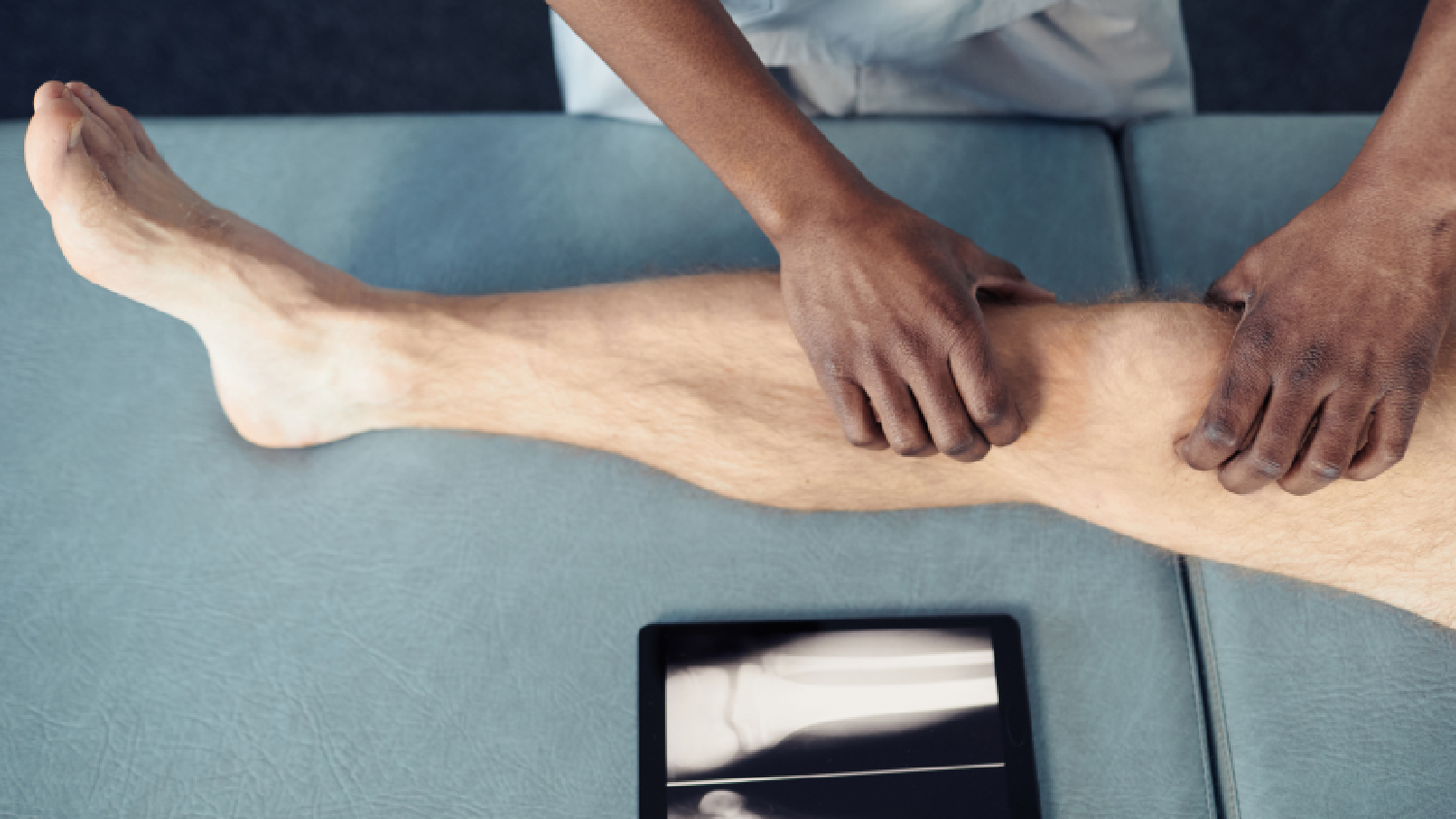 anatomical-chart-demonstrating-improper-tracking-of-the-patella-within-the-femoral-groove (1)