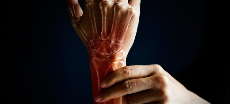 anatomical-graphic-showing-an-inflamed-swollen-bursa-sac-squeezed-between-a-tendon-and-a-bone