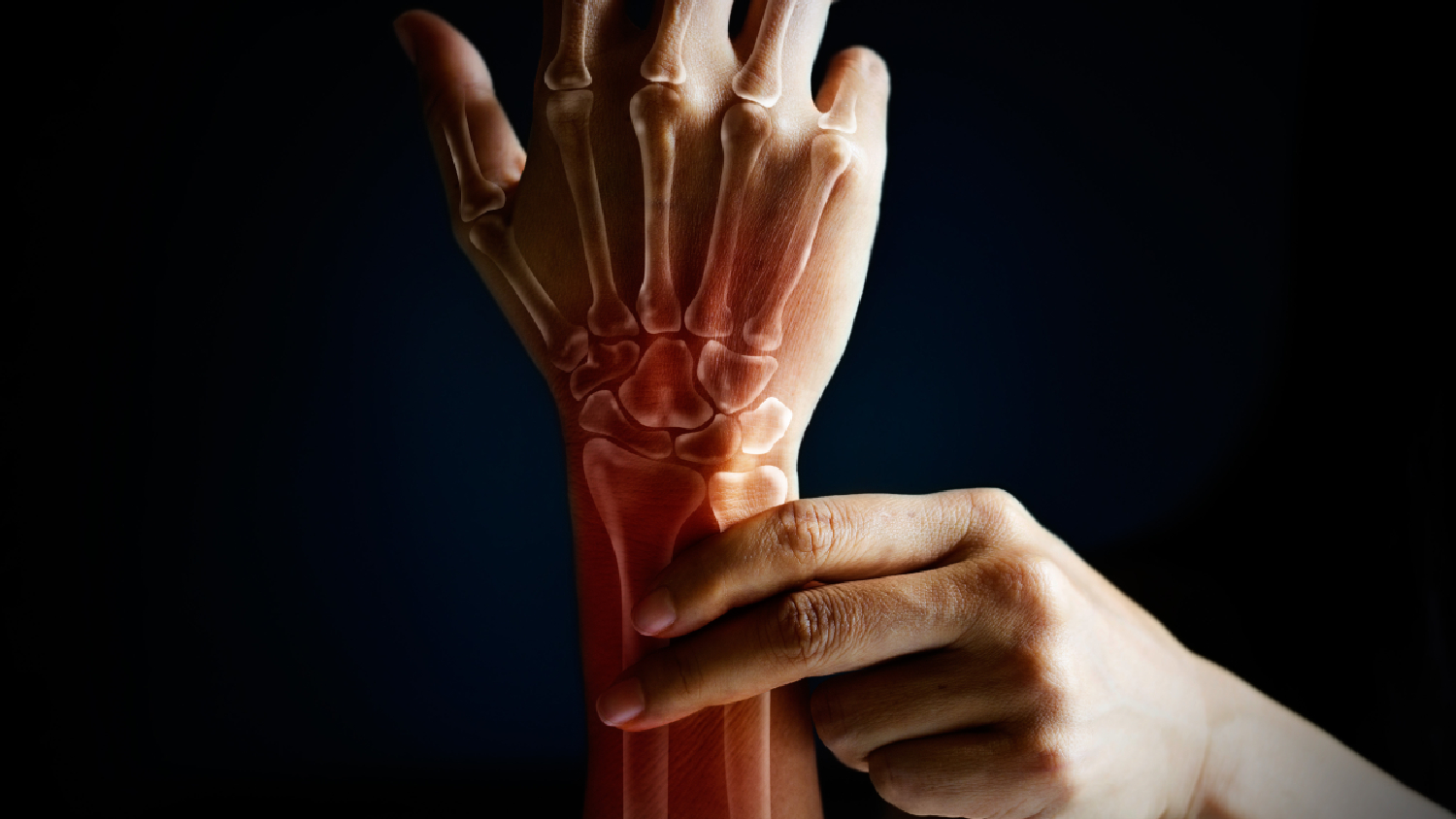 anatomical-graphic-showing-an-inflamed-swollen-bursa-sac-squeezed-between-a-tendon-and-a-bone